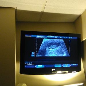 Meet your Posher, Rober